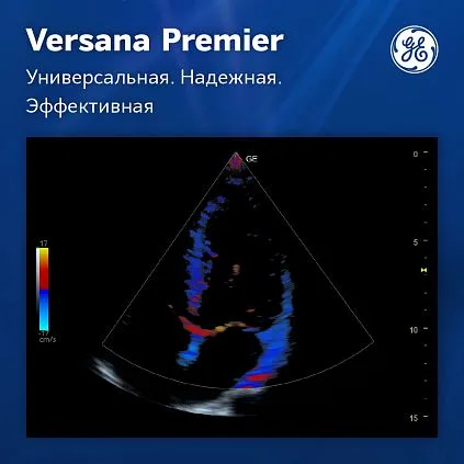 Клинические изображения Ультразвуковая система GE Versana Premier Black